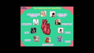 Aortitis Symptoms and Causes  Diagnosis  Treatment  Prevention healthcare [upl. by Surad]