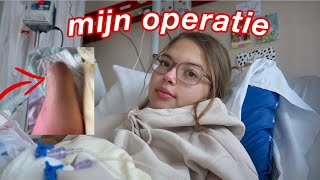 MIJN OPERATIE AAN MIJN GEAMPUTEERDE BEEN vlog [upl. by Lenahs33]