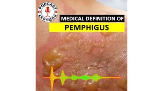 Pemphigus Medical Definition of Pemphigus HaileyHailey disease Podcast [upl. by Bartolome]