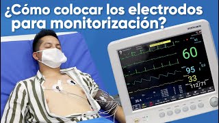 ¿Cómo colocar los electrodos para monitorización [upl. by Eohce]