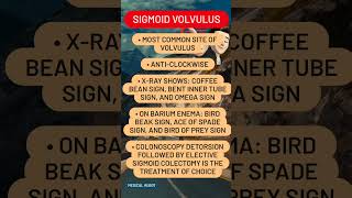 Sigmoid volvulus [upl. by Nawud]