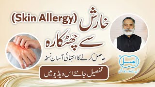 How to Treat Skin Allergy [upl. by Nickolaus379]