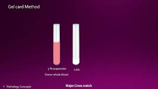 Major Crossmatch Tube method amp gel card method [upl. by Trevor]