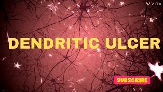 Dendritic ulcer  ULCER  OPHTHALMOLOGY USMLE  NEETPG  INICET  NEETPG MBBS SCIENCEPARADISE [upl. by Weisbrodt]