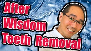 Wisdom Teeth Removal Aftercare [upl. by Roscoe]