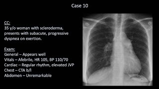 How to Interpret a Chest XRay Lesson 10  Self Assessment Part 2 [upl. by Erodavlas]