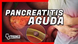 😖 Pancreatitis aguda ⚠ Definicion síntomas fisiopatología causas tratamiento [upl. by Onifled]