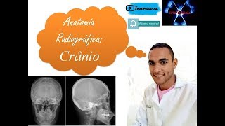 Anatomia Radiográfica do Crânio [upl. by Arbba]