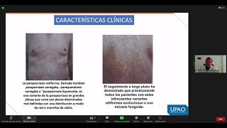 DERMATO 4 PARAPSORIASIS EN GRANDES PLACAS [upl. by Nonnac]