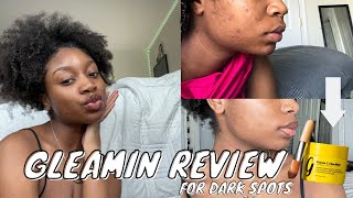 Gleamin Review The Best Face Mask for Hyperpigmentation Does it REALLY work with pictures [upl. by Nichol565]