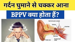 BPPV क्या हैं causes symptoms amp treatment in Hindi  Benign paroxysmal positional vertigo [upl. by Notecnirp623]