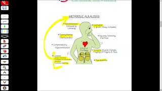 Metabolic Alkalosis  Davidson Medicine  UrduHindi [upl. by Lawson557]