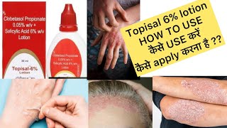 Topisal 6 percent how to use   topisal lotion kaise use karein  how to use topisal 6 percent [upl. by Okiam847]