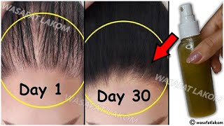 This remedy Will treat baldness and thinning edges of hair within 1 month 🌿 Use it 2 times a week [upl. by Nnave561]