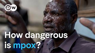 New mpox virus Why is it spreading so quickly  DW News [upl. by Paten]