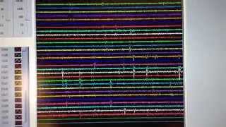 Live data  Cambridge NeuroTech silicon probes with wireless recording in a freely behaving rat [upl. by Anerol]