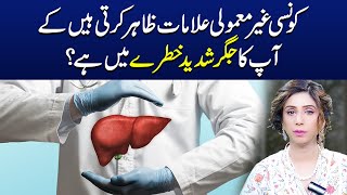 Unusual Symptoms That Indicate Your Liver Is in Serious Danger  Dr Sahar Chawla [upl. by Cardew]