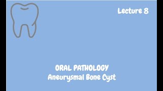 Aneurysmal Bone Cyst Complete Lecture  For NBDE NDEB MDS amp FCPS [upl. by Sadiras]