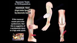 Squeeze Test In Orthopaedics  Everything You Need To Know  Dr Nabil Ebraheim [upl. by Ettenahc621]