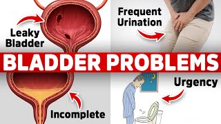 The 1 Vitamin Deficiency behind Bladder Issues Freq Urination Leaky Urgency [upl. by Ventura337]