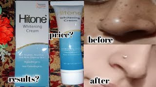 hitone whitening cream  best medicated cream for skin brightening amp freckles  pigmentation [upl. by Ocsirf136]