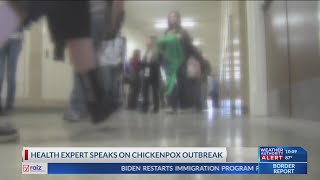 CISD Middle school student tests positive for chickenpox [upl. by Kaliope]