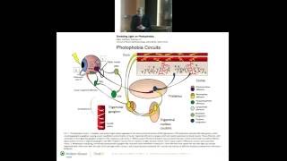 Pathophysiology of Blepharospasm and Photophobia [upl. by Leupold]