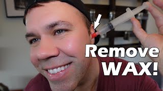 How To Remove Wax from Ears at Home Safely Using Hydrogen Peroxide or Olive Oil [upl. by Herrle]