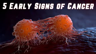 5 Early Signs of Cancer [upl. by Sharity4]