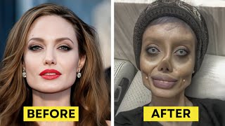 20 Times Plastic Surgery Gone Wrong [upl. by Ttehc725]