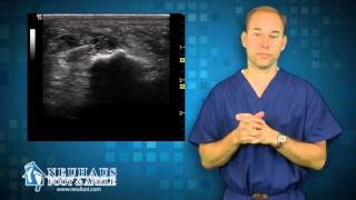 How Ultrasound is used to treat Plantar Fasciitis Heel Pain [upl. by Ilanos]