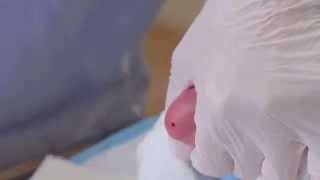 CLSI Newborn Screening DVD  Informational Video Trailer [upl. by Mullac]