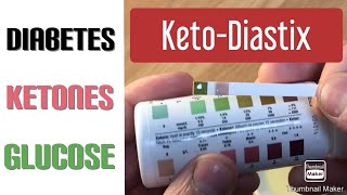 How To Read Ketone Strips [upl. by Achorn]