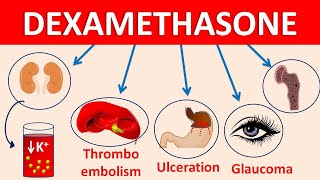 Dexamethasone tablets decadron  Mechanism side effects amp precautions [upl. by Placeeda]