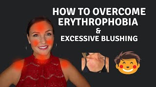 How To Cure Erythrophobia amp Excessive Blushing [upl. by Aihsenak]