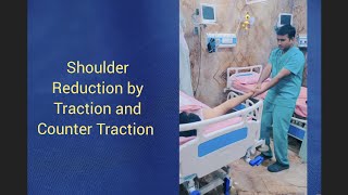 Anterior Shoulder Dislocation Reduction by Traction Counter Traction Method [upl. by Euqinomad441]