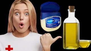 benefits of vaseline and aromatic ginger [upl. by Oreves164]