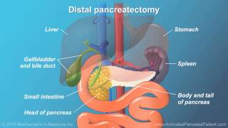 Pancreatic Surgery Benefits Risks and Relevant Anatomy [upl. by Aniroz]