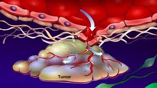 Introduction to Cancer Biology Part 4 Angiogenesis [upl. by Sharon]