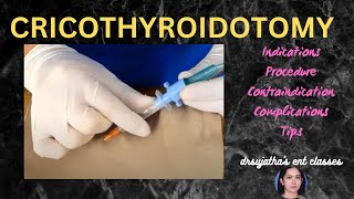 205cricothyroidotomy cricothyrotomy procedure airway emergency stridor [upl. by Layman526]