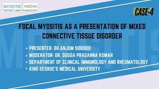 CASE 4 Focal Myositis as a presentation of Mixed Connective Tissue Disorder Dr Anjum Siddiqui [upl. by Fong]