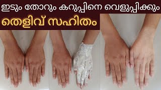 ഒരുദിവസത്തിനുള്ളിൽ Skin brightening face packകറുപ്പ് നിറം വെളുപ്പിച്ചത് തെളിവായി കാണാം😱 [upl. by Nuahsal262]