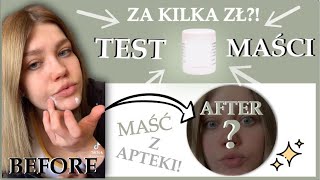 Test pasty cynkowej za 4 zł z apteki przed i po [upl. by Aima]