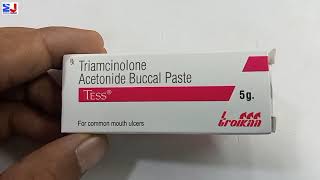 Tess Paste  Triamcinolone Acetonide Buccal paste  Tess Paste uses side effect benefit Review Hindi [upl. by Asiel415]