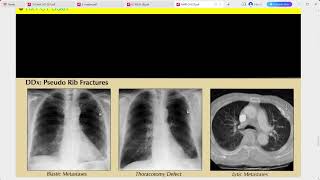 RADIOLOGY EXAM CASES [upl. by Lordan]