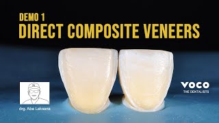 Step by Step Direct Composite Veneers Restoration with 2 Layers Technique using AMARIS  VOCO GmbH [upl. by Maurita116]