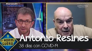 Antonio Resines habla sobre su larga lucha contra el Covid  El Hormiguero [upl. by Stichter]