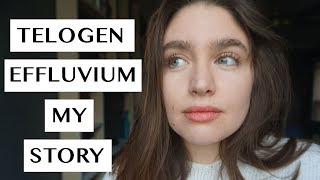 TELOGEN EFFLUVIUM  MY RECOVERY STORY  LAUREN NEWLY [upl. by Newob]