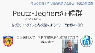 PeutzJeghers症候群 ―診療ガイドラインと内視鏡によるポリープ治療の紹介― [upl. by Ahseit231]