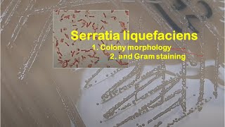 Serratia liquefaciens Colony morphology and Gram staining [upl. by Thordia]